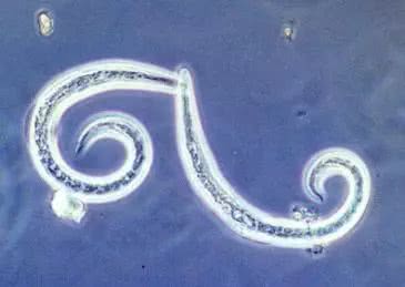 宝宝感染寄生虫有什么症状,宝宝有寄生虫是不是宠物感染的