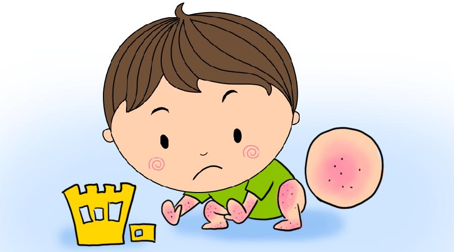如何通过日常护理来预防湿疹复发,宝宝湿疹大人怎么办