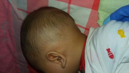 宝宝睡觉出很多汗是不是积食,宝宝睡觉出虚汗会冷