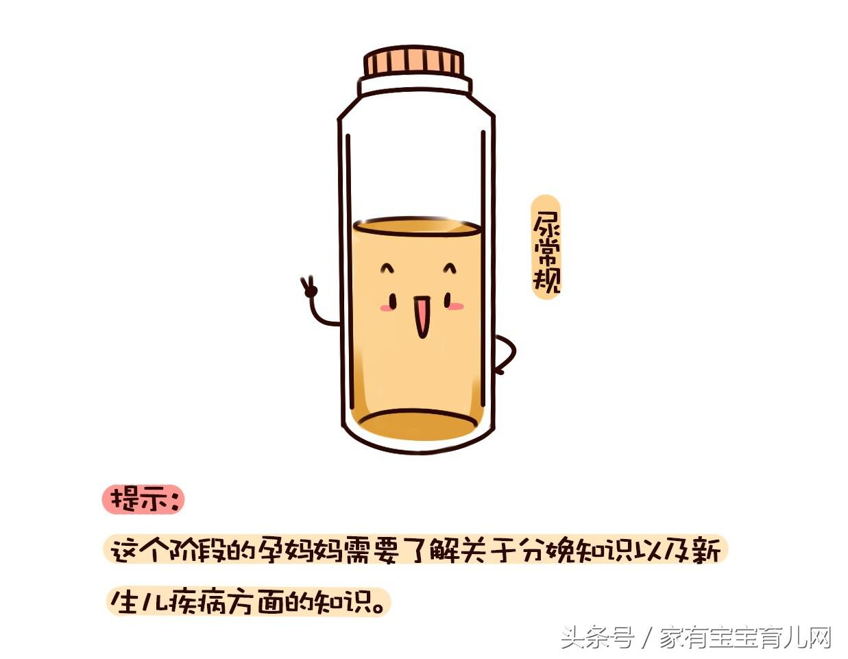 产检糖耐检查流程,最全的产检时间表和项目唐氏