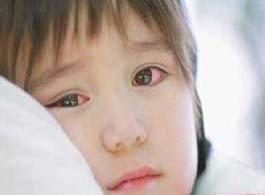 孩子得了结膜炎的图片,得了结膜炎眼睛很模糊