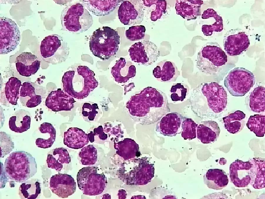 抗癌药澳洲 (澳洲抗癌药)