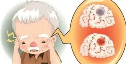 诊室也是小课堂，彭康告诫患者：头痛别忘查鼻窦、“三高”怎样防治、三七粉不应盲目服用……