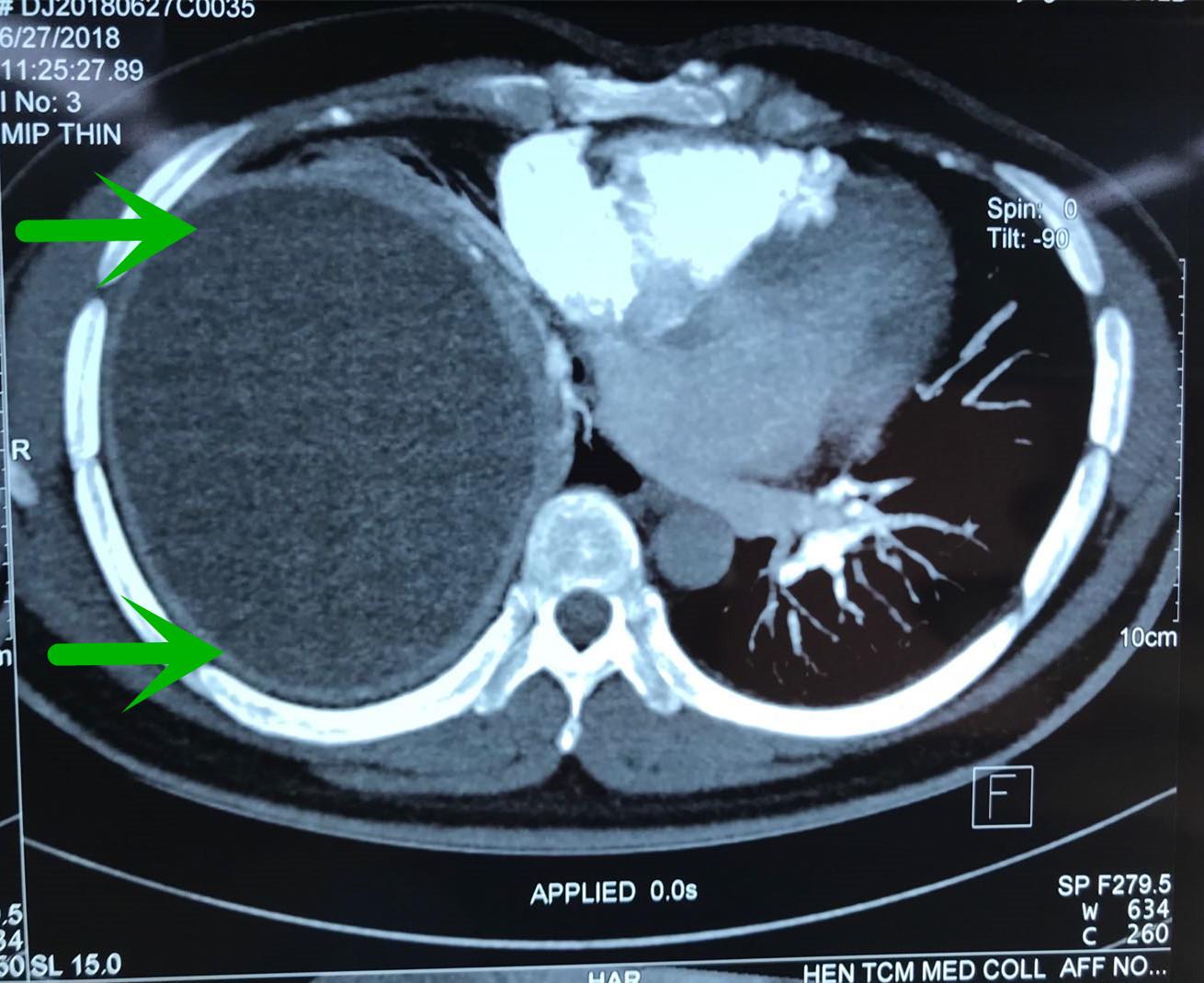 郑大一附院河医区手术室,河大一附院手术室