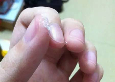 手上沾了502胶水用什么洗,如何快速洗掉502胶水