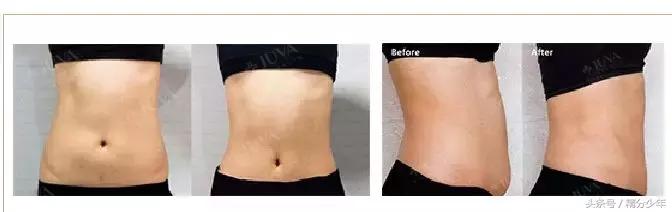 顽固性易胖体质怎么瘦下去,145斤易胖体质能瘦下来吗