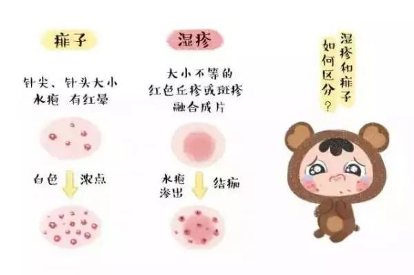 宝宝身体痒怎么缓解,宝宝瘙痒妙招
