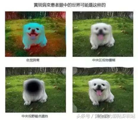 黄斑病变是眼癌吗,致眼盲疾病有哪些