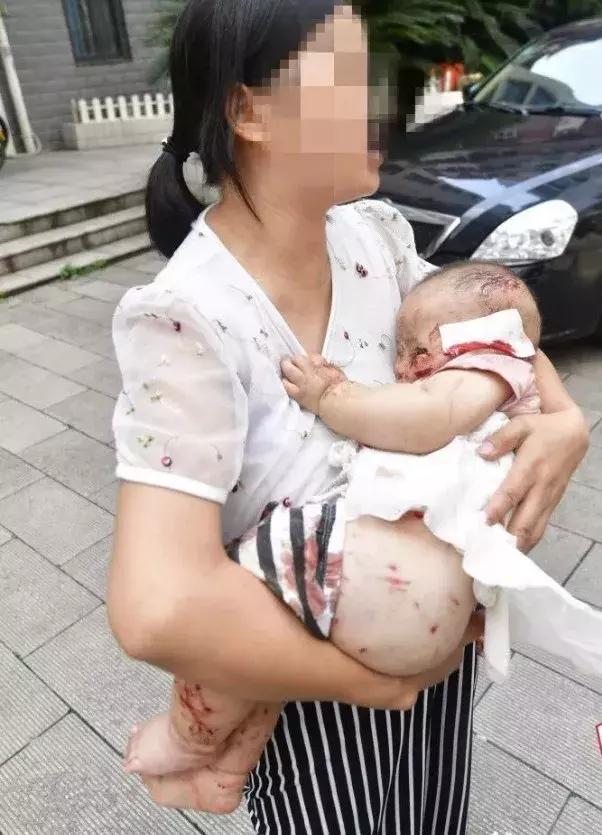 小区狗咬狗事件后续,小区内狗咬人怎么处理