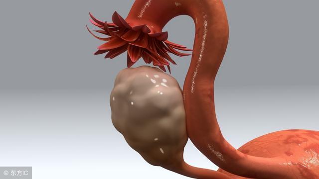 宫颈息肉如果是恶性的有什么症状,宫颈息肉有6个前兆严重吗