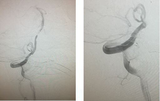 心血管内科急救流程,急诊静脉用药方法