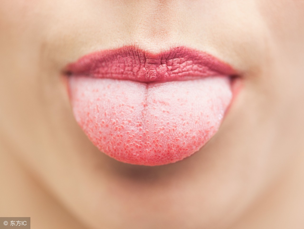 十人九湿气重怎么除湿,十人九湿怎么快速排湿