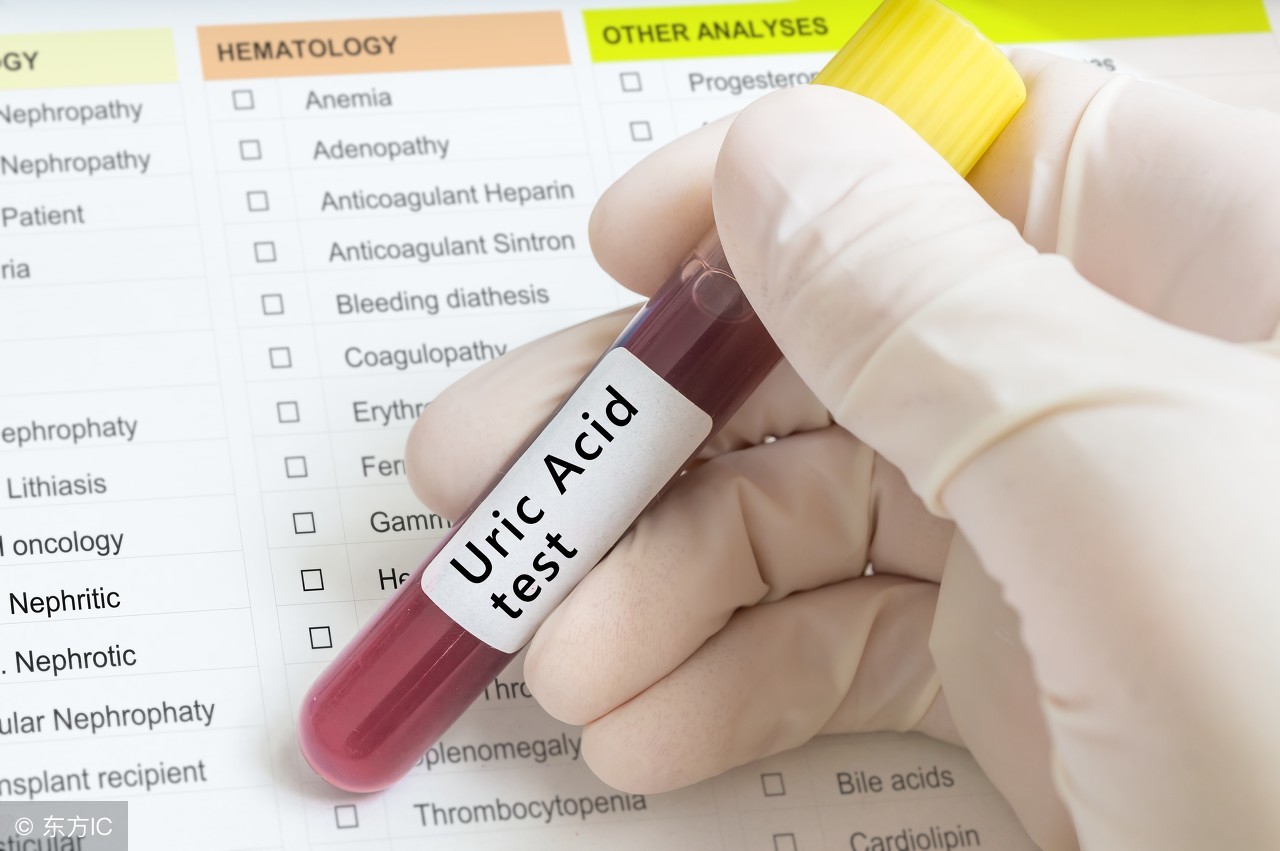 尿酸700出现痛风了怎么办,尿酸700但是不痛风