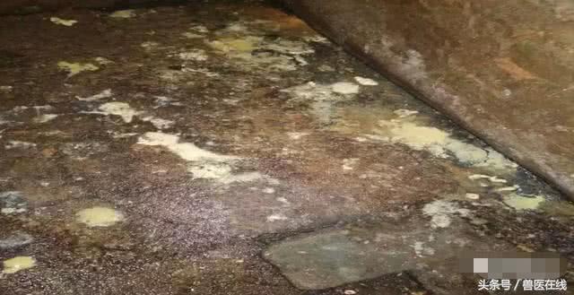 一场阴雨天引发的腹泻，值得养猪人深思！