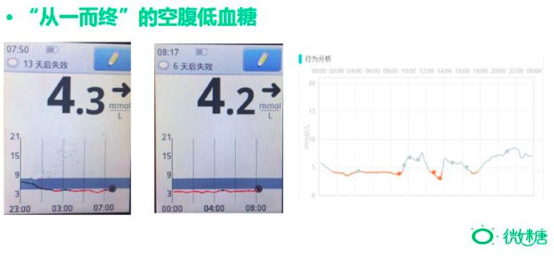 空腹运动低血糖正常吗,半夜低血糖吃了糖算不算空腹