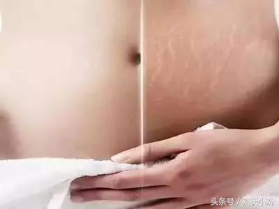 怀孕八个月孕妇全身痒是怎么回事,孕妇7个月肚皮发痒是怎么回事