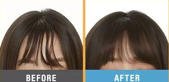 防油腻指南,厨房防水防油腻妙招