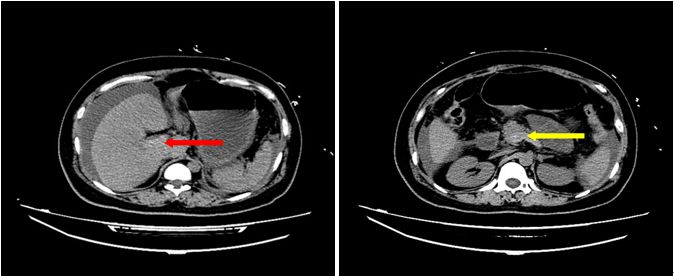 你有一线生机，我必万分努力｜规培医师ICU轮转纪实