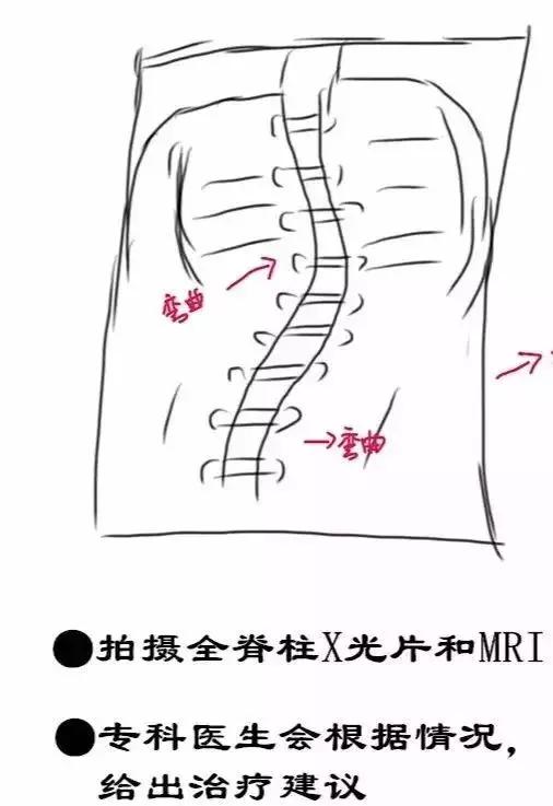 23岁姑娘撩起上衣,妈妈一看急疯了!暑假孩子一窝蜂看这病,再晚要吃大苦头!