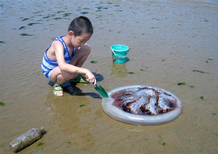 海蜇蜇伤后印记如何消除,海蜇蜇人用尿液管用吗