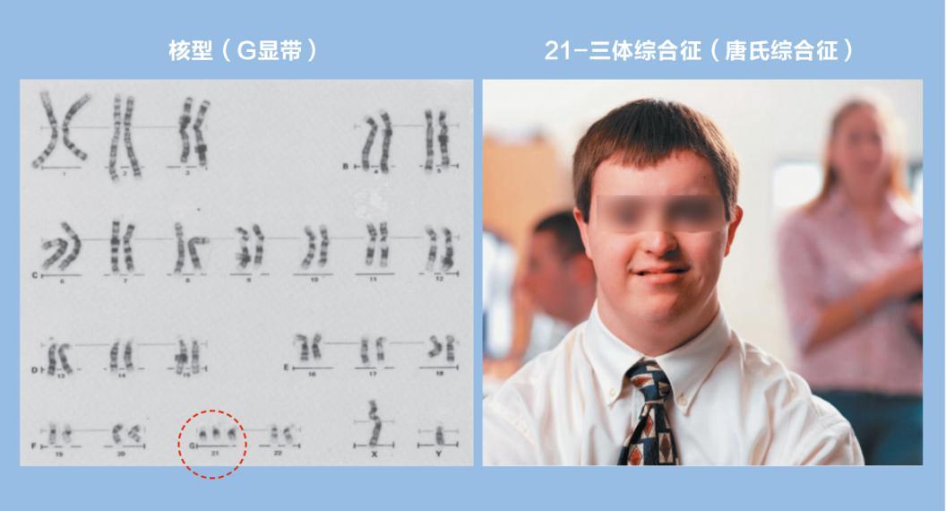 羊水穿刺太可怕所以去做无创DNA检测?协和妇产专家谈羊穿恐惧症