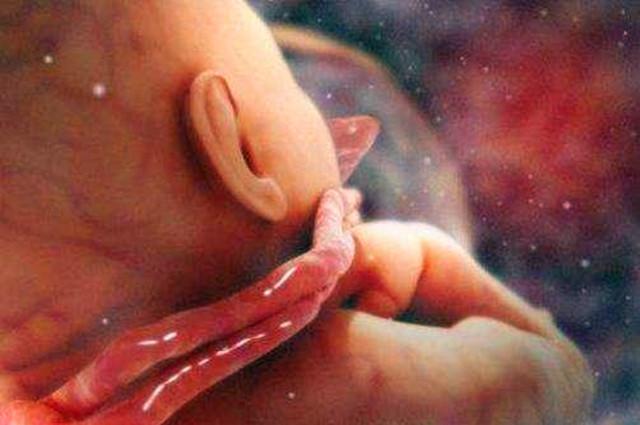 如果胎儿已经脐带绕颈怎么解决,胎儿脐带螺旋稍密集孕妈该怎么办