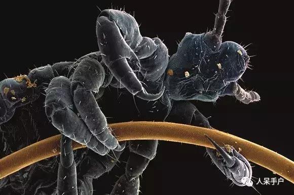 这个昆虫告诉我们人类何时开始穿上衣服？