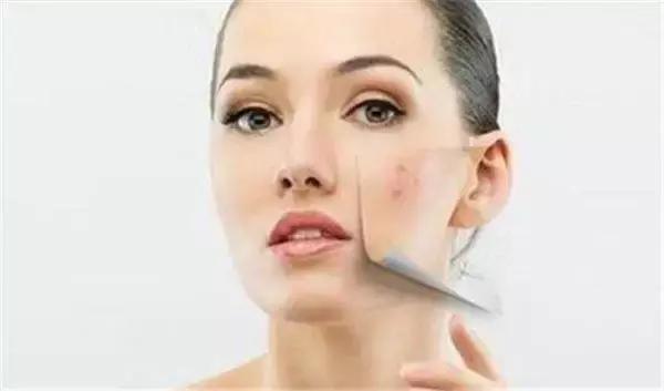 可怕！她把痔疮膏当眼霜涂了以后……差点儿毁容了！