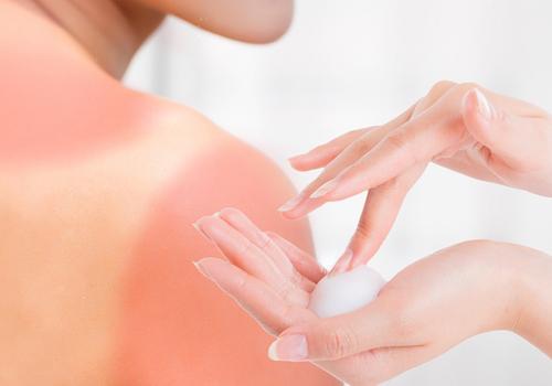 皮肤晒后泛红怎么修复,头皮晒后发红痒怎么办