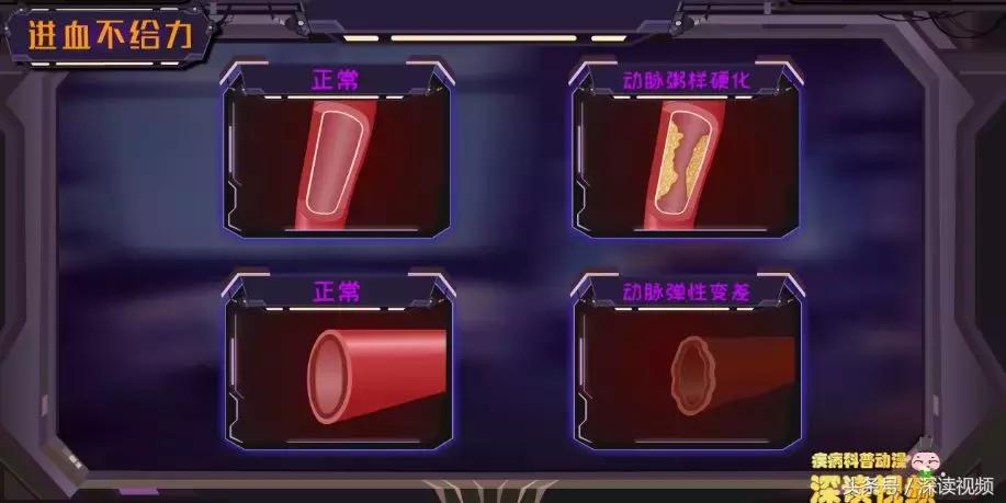 谁让你“兄弟”不给力,谁让你“痿”靡不振?阳痿诱发因素知多少