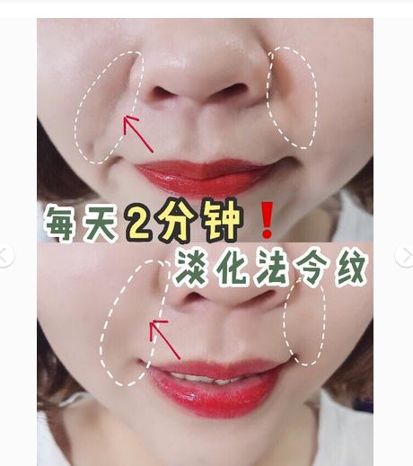 5步0成本淡化法令纹你学会了吗,经常鼓嘴或吹气可以消除法令纹吗