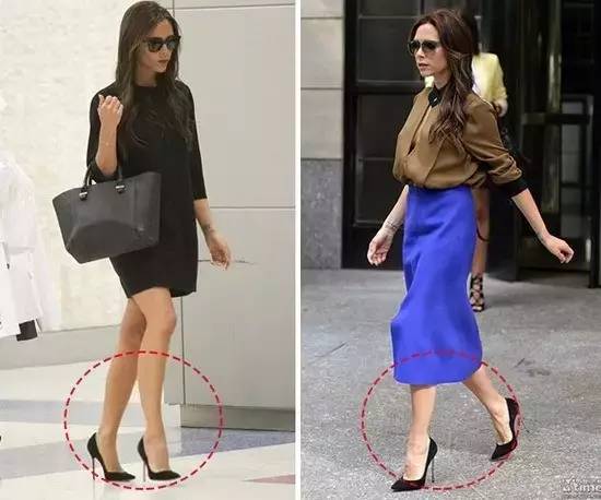 女孩脚肿瘤,25岁女性脚趾长肿瘤