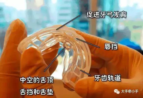 牙齿不齐矫正好还是做牙冠好,牙齿不齐矫正1个月的变化