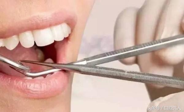 拔牙以后不要咽口水,拔牙后注意事项可以刷牙不
