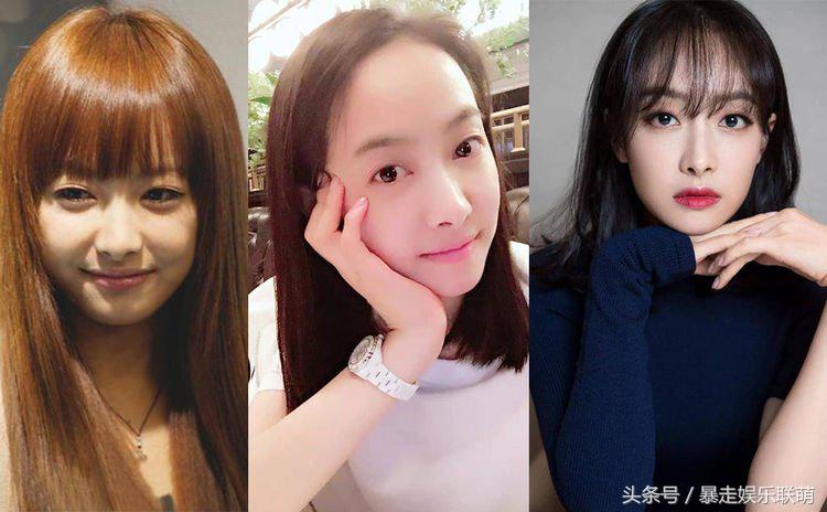 女明星的发际线高的是怎么回事,额头发际线高很难看怎么办