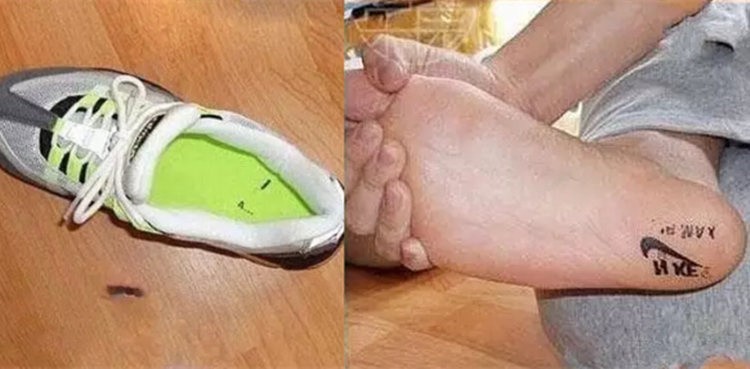 1400元凉鞋掉色脚上染出鞋这些人的脚丫比她还惨