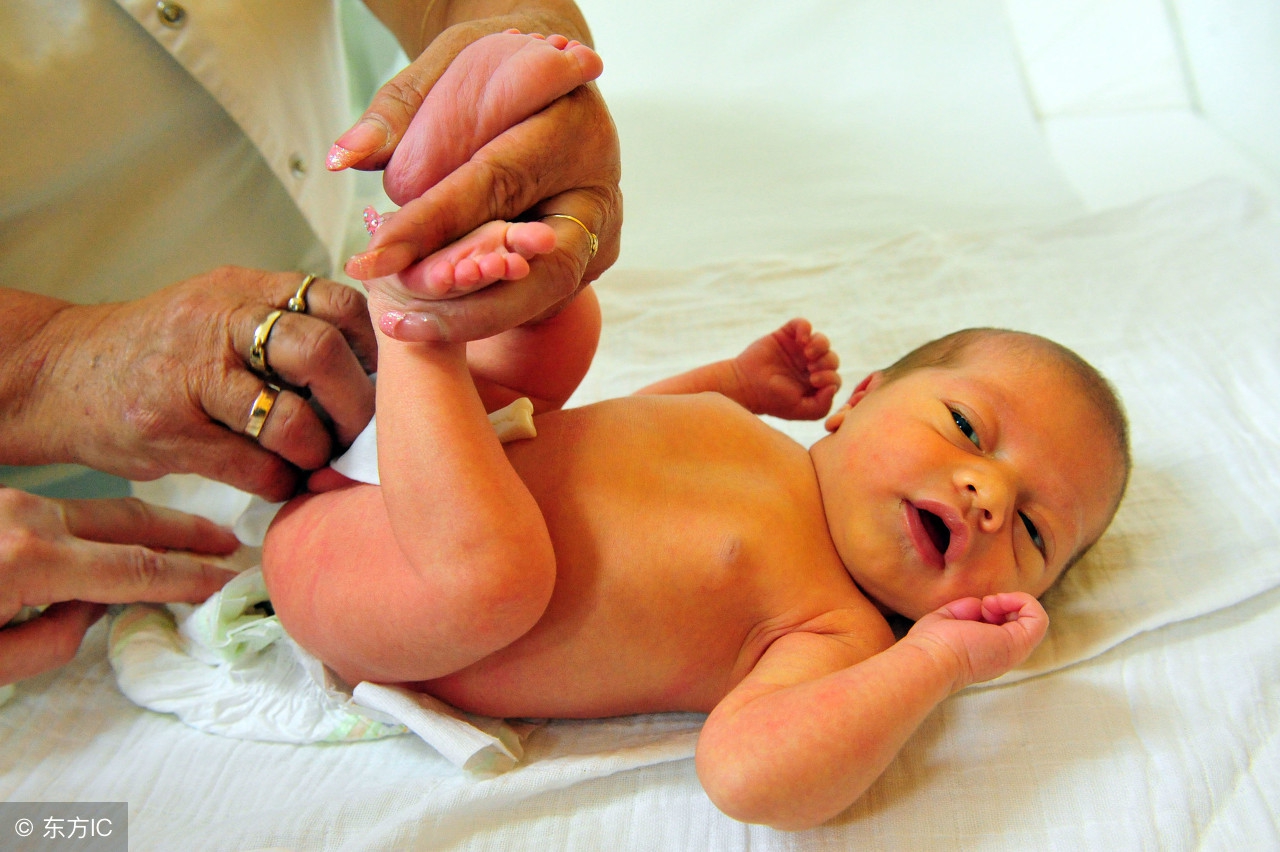 怎么彻底摆脱湿疹,解决宝宝湿疹的几种药膏