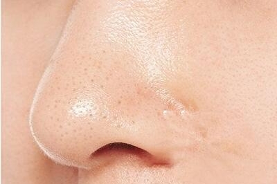 都8102年了，还用这些方法祛黑头，你的脸还好吗？