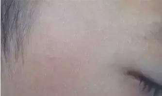 娃儿身上长“可可”该挂哪个科,妈老汉儿遇到这种情况最容易打蒙!