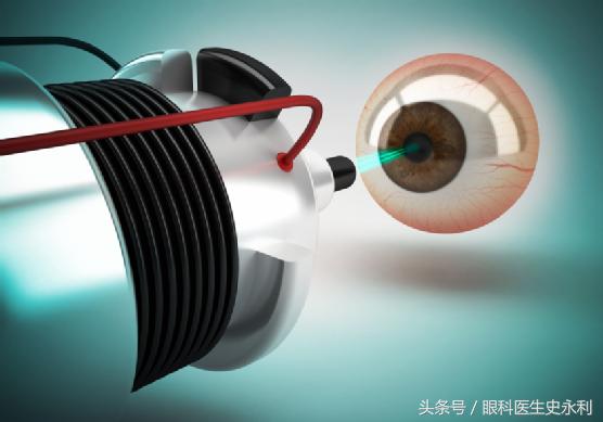 眼科医生为您科普近视眼手术的利与弊，想手术看完以后再决定！