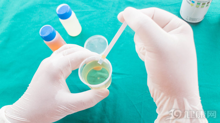 尿检最怕的三种指标是什么,尿检各项指标详解