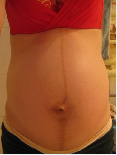 怀孕37周想提前顺产有什么办法吗,有孕37周自然发动生孩子的吗