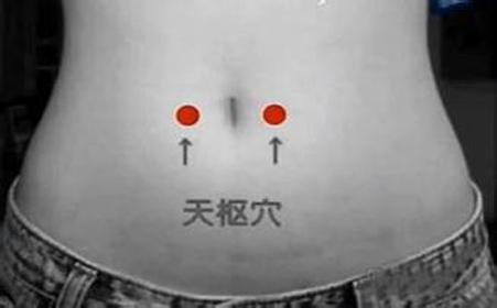 针灸减肥是天天灸好还是隔天灸好,减肥灸肚子灸哪个部位