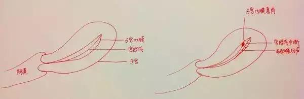 卵泡11mm子宫内膜厚度8mm,子宫内膜厚度和卵泡大小有关系吗