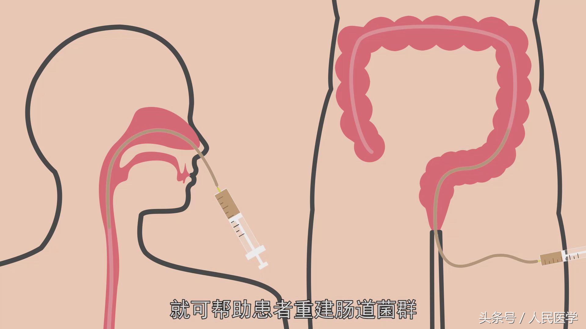 “吃屎能救命”是真的吗？千万别在吃饭的时候看！