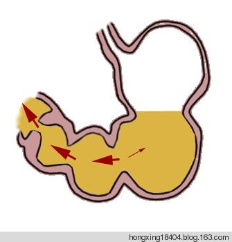 胃肠道常见疾病诊疗及管理,卫生与健康的建议