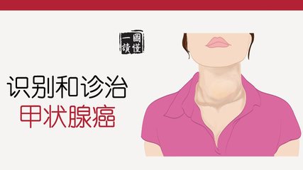 甲状腺良性结节是否会转变为甲状腺癌?甲状腺癌怎么办?