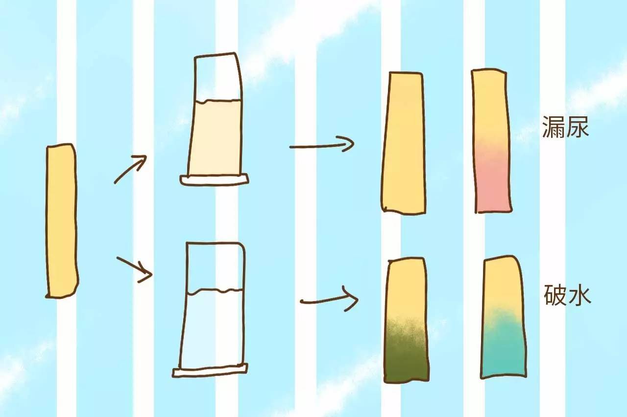 孕妇羊水早破,孕妇羊水提前破了该怎么办