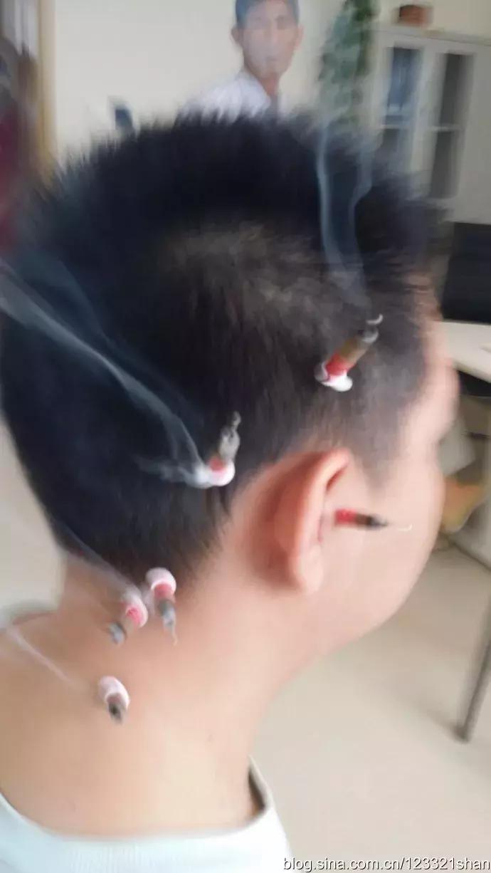 关于儿童近视的10个最常见问题,关于儿童近视的28个最常见问题