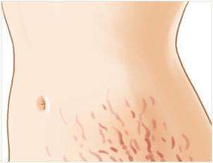 女性怀上之后，腹部会有这4种变化，你都知道吗